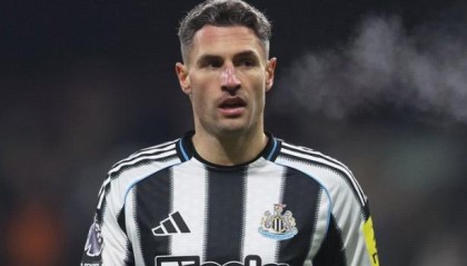 JRS直播吧-埃迪-豪：舍尔昨天手术很成功，目标为三个月恢复期